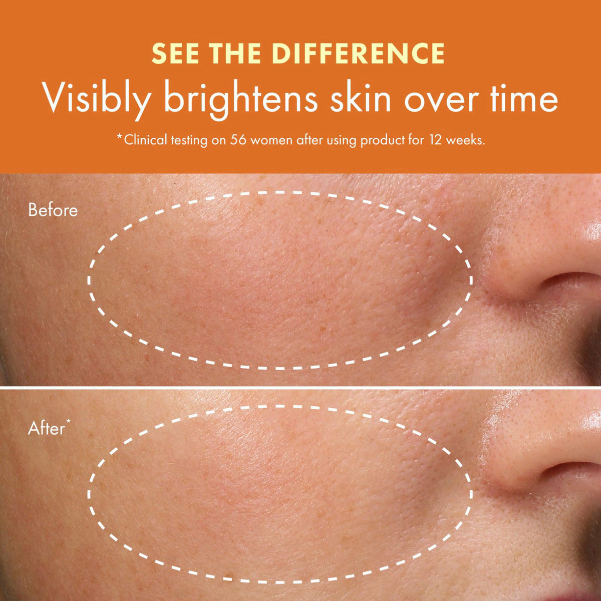 Origins GinZing Energizing Gel Cream | Face Moisturizer for Radiance and Glow | With Vitamin C, Niacinamide, Ginseng, an