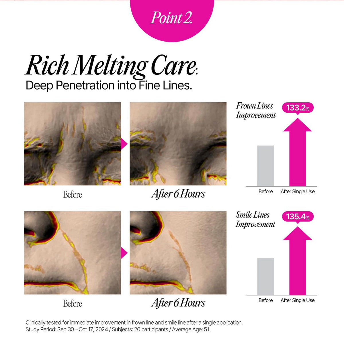 LOLOSKINNY Hydrogel Collagen Face Wrinkle Patches - 90 Sheets Bulk Pack for Daily Korean Skin Care Routine - Targeted An
