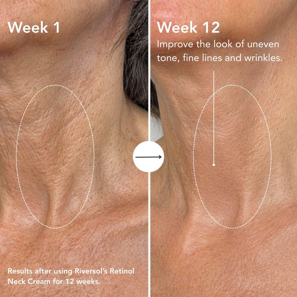 Riversol Retinol Neck Firming Cream for Tightening & Wrinkles – packaging and label
