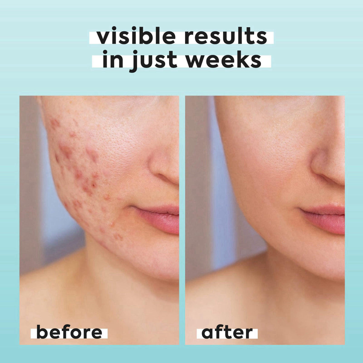 LivaClean – Pore Cleansing Strips on display