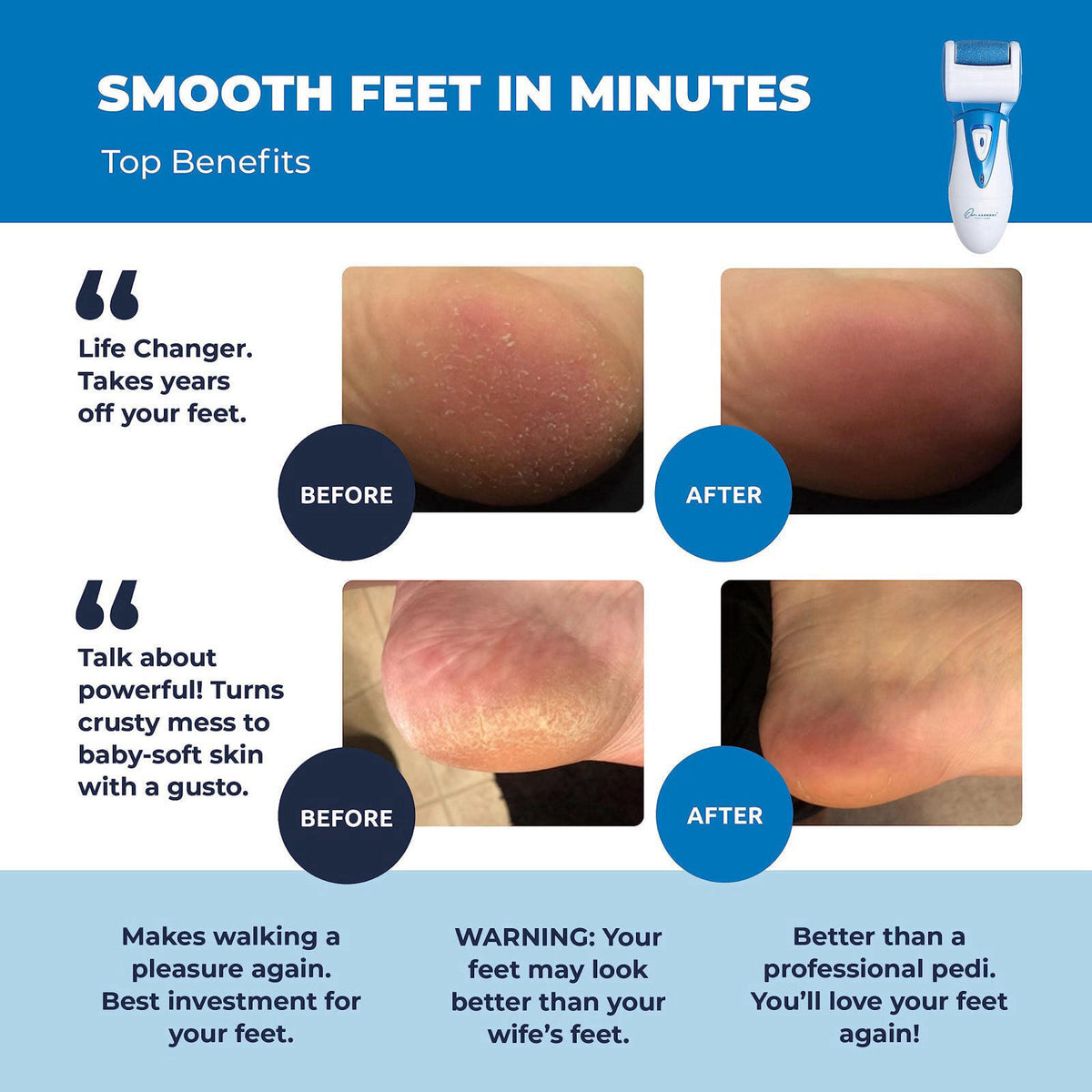 Own Harmony Electric Foot Callus Remover - Rechargeable Pedicure File Tool – close-up detail in Blue