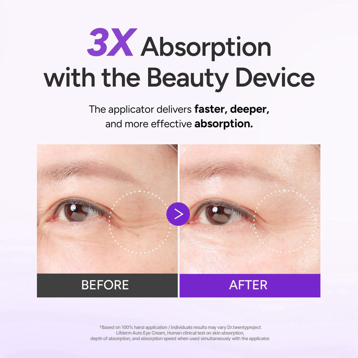 Dr.twentyproject Lifderm Eye Cream with Collagen & Vibrating Device for Wrinkles, Anti-Aging, Dark Circles – Lifting, Fi