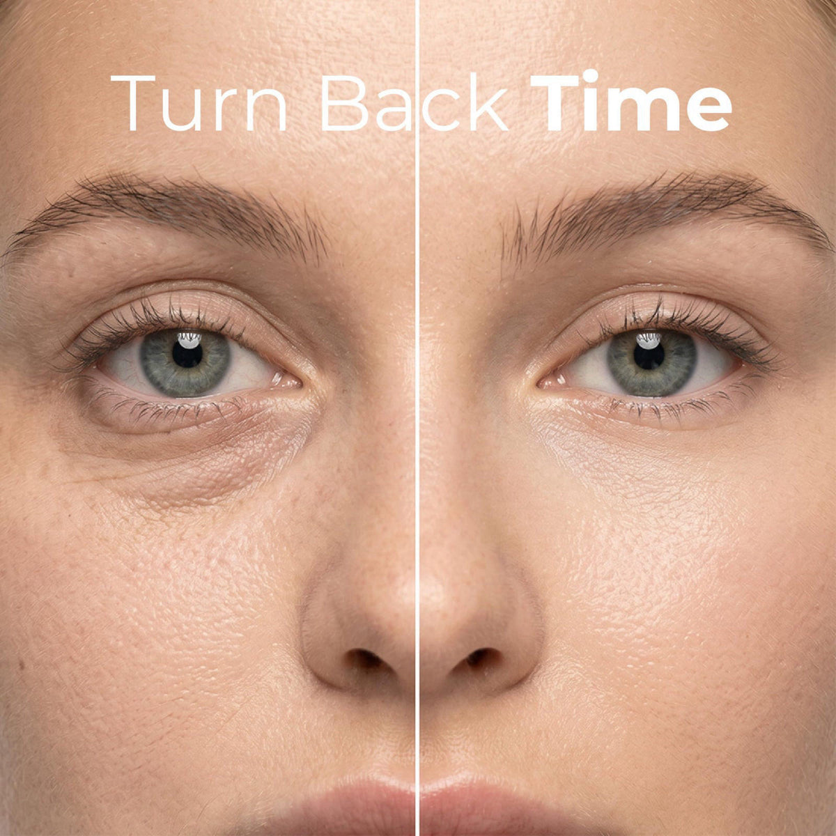 LIVAURA Retinol Under Eye Patches for Women - Eye Masks for Dark Circles – close-up detail