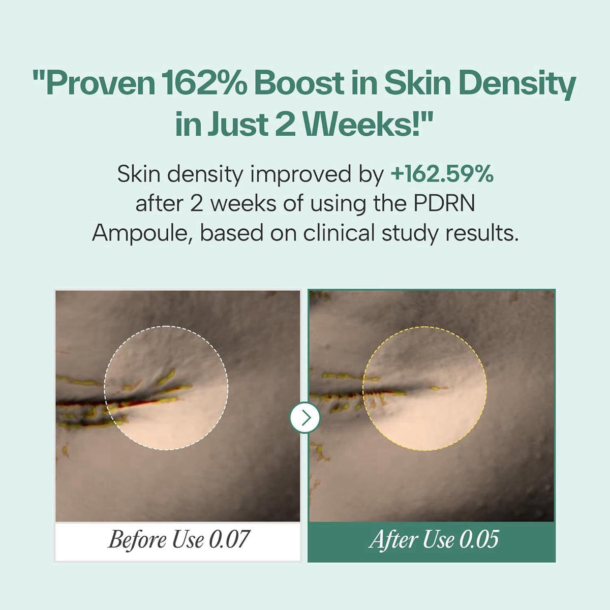 Maybena PDRN Revitalizing skincare Duo - Ampoule 30ml + Cream 50ml – close-up detail