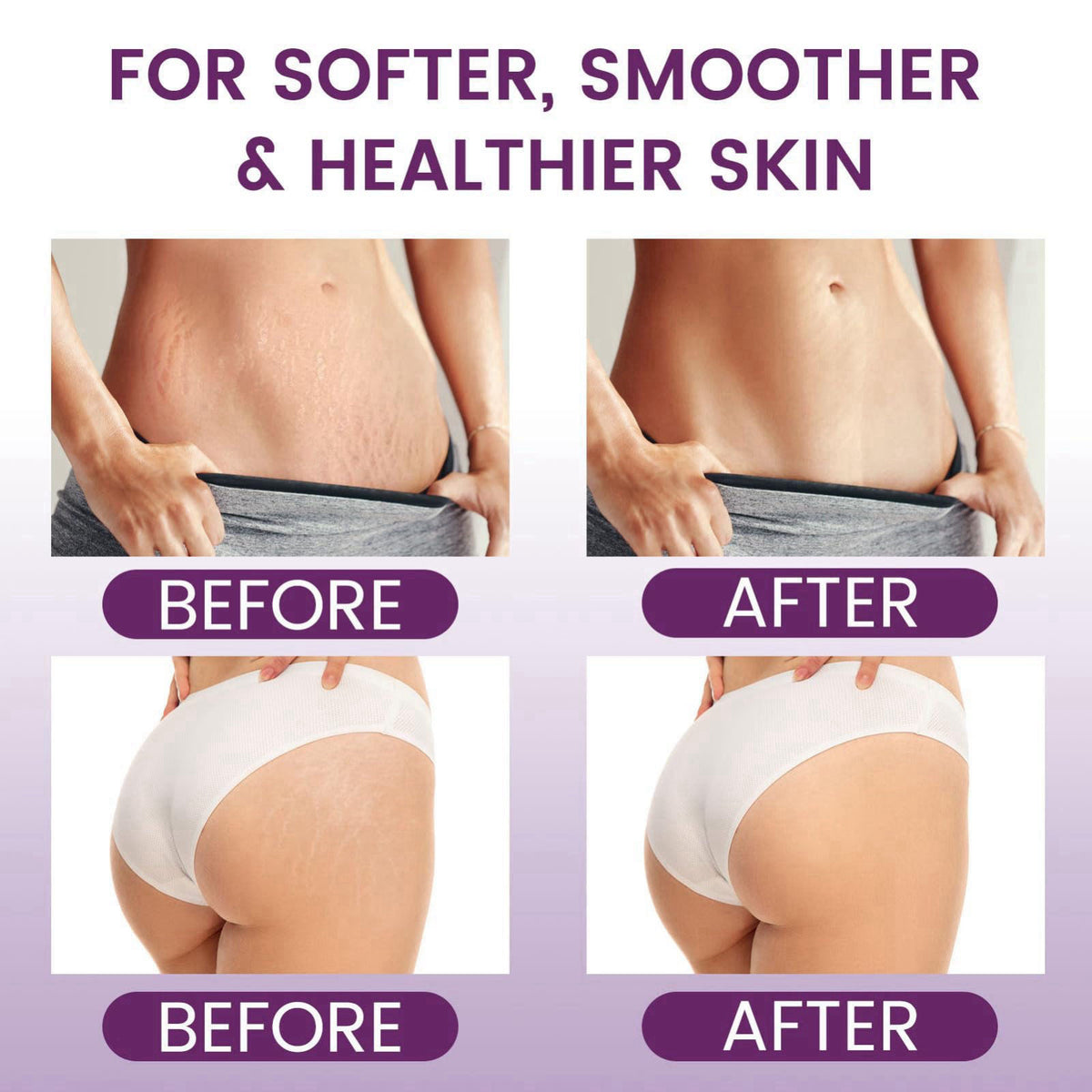 AOAO Pregnancy Moisturizing Skin Care Set, Safe Support Skin Elasticity – full view