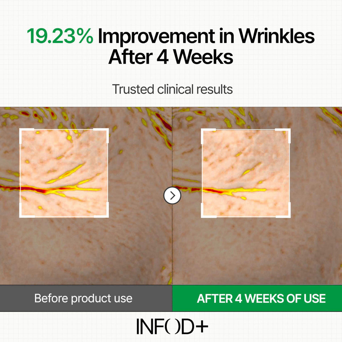INFOD+ INFODPLUS Sensitive Skin Moisturizer Face Cream with Ceramide and Panthenol, Barrier Repair Support Hydrating Soo