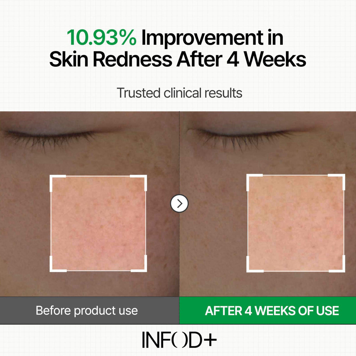 INFOD+ INFODPLUS Sensitive Skin Moisturizer Face Cream with Ceramide and Panthenol, Barrier Repair Support Hydrating Soo