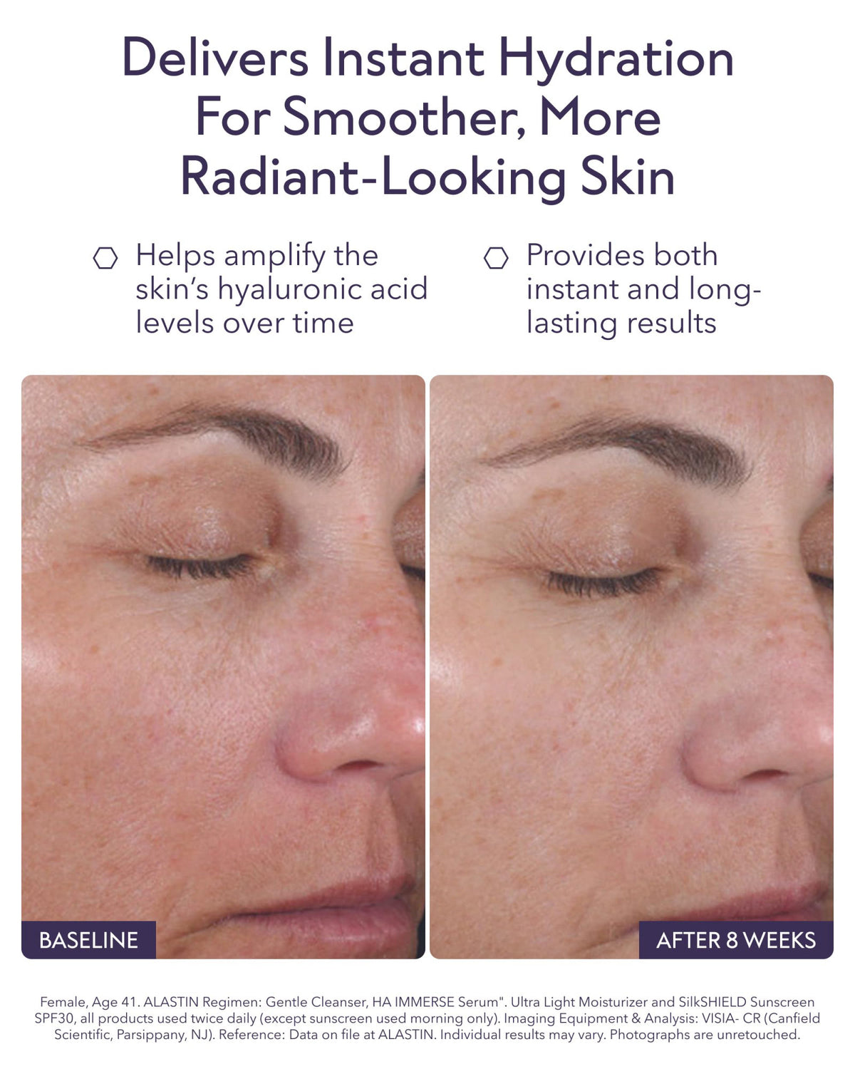 ALASTIN Skincare HA IMMERSE Hyaluronic Acid Moisturizing Face Serum (1 oz) – packaging and label