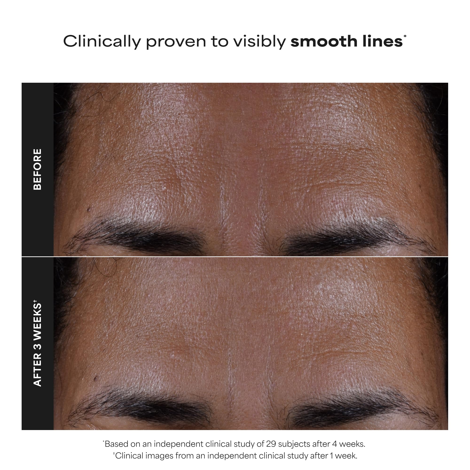 Paula's Choice Skin Perfecting 2% BHA Liquid Exfoliant bottle, 4oz, showing the product label and transparent liquid inside.