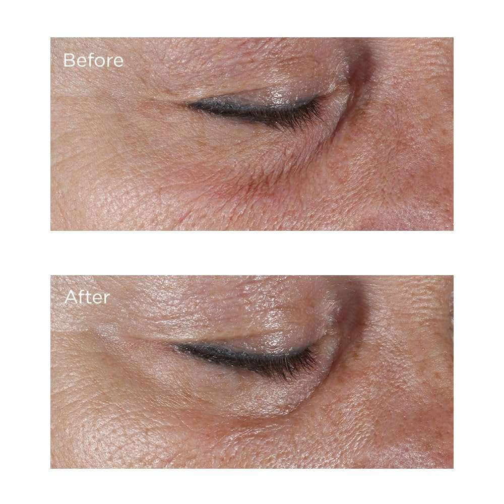 Perricone MD Firming Eye Cream with hyaluronic acid in a 0.5oz jar, designed to hydrate and tighten the delicate eye area.