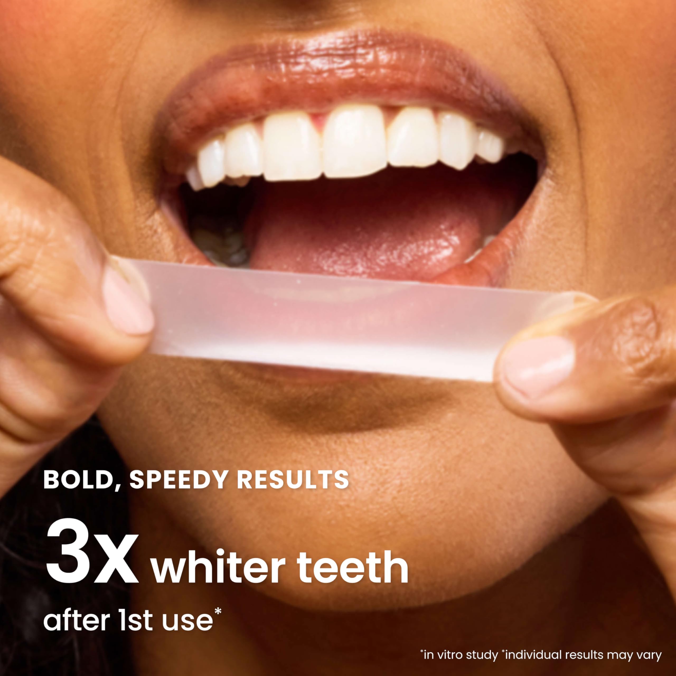 Quip Dissolvable Whitening Strips for teeth, 20 treatments, featuring clear packaging and easy-to-apply design.