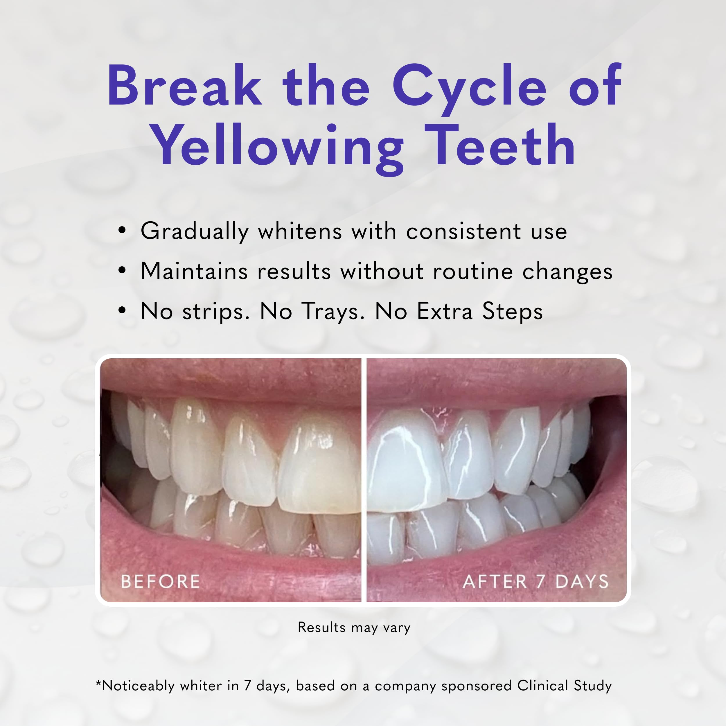 Smileactives Pro Whitening Gel in 2oz clinical-grade tube, whitening teeth with professional-grade formula.