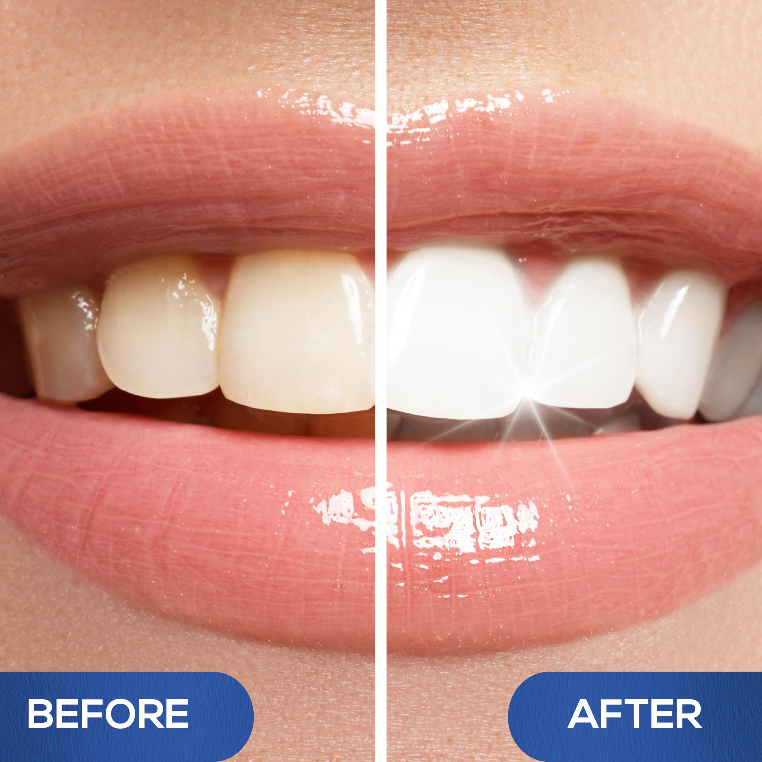 Venus Visage teeth whitening pen pack of 4, each with over 30 uses, showcasing the whitening pens with white caps and applicators.